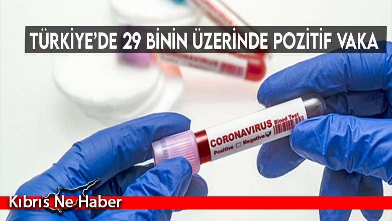 Türkiye’de 29 binin üzerinde pozitif vaka