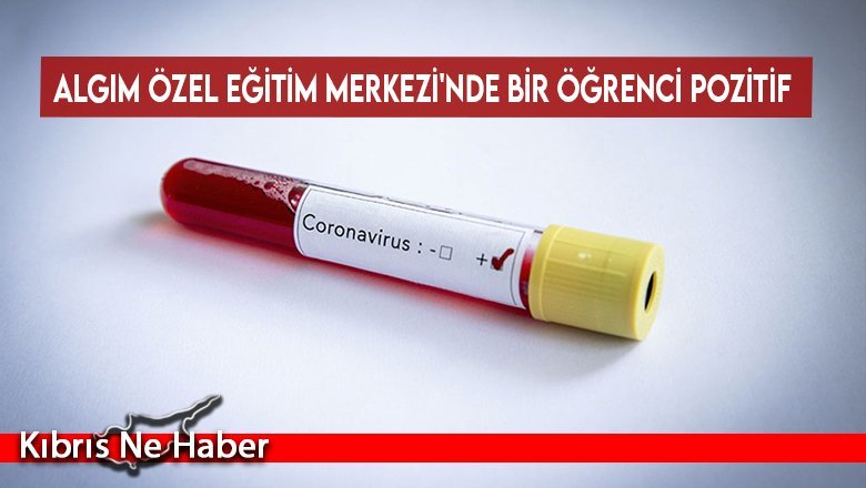 Algım Özel Eğitim Merkezi'nde Bir Öğrenci Pozitif