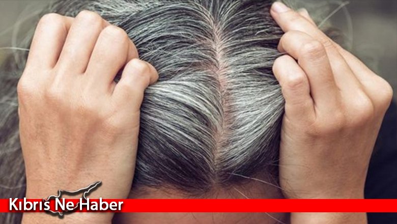 Gen tedavisi ile saç beyazlaması son bulacak!