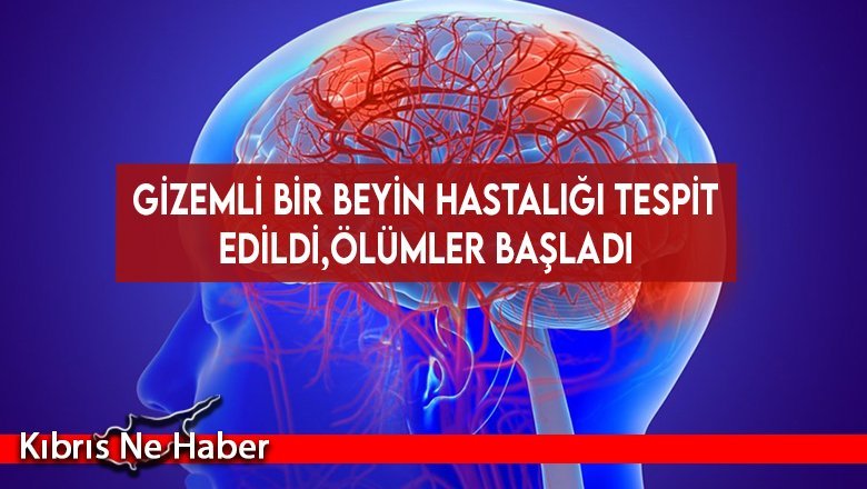 Kanada’da gizemli beyin hastalığı!