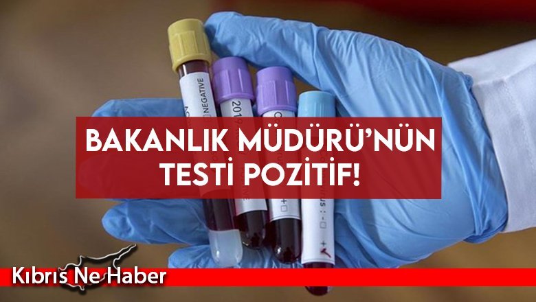 Bakanlık Müdürü’nün testi pozitif!