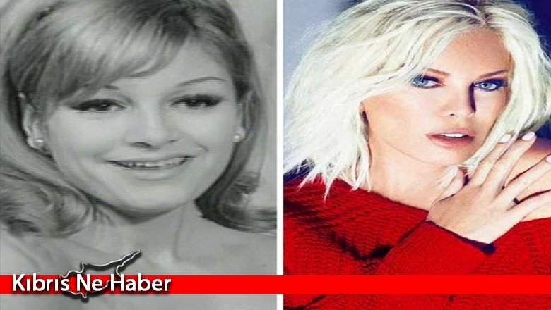 Estetikli halleri ile dünya güzeli olan ünlülerin estetiksiz halleri