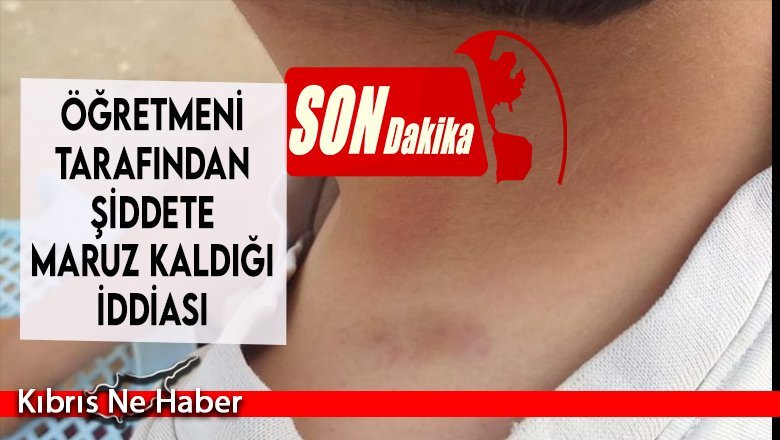 Şok Olay ! Öğretmeni tarafından Şiddete maruz kaldığı iddiası