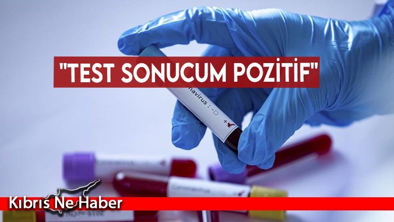 Buray Büsküvütçü: "Test Sonucum Pozitif"