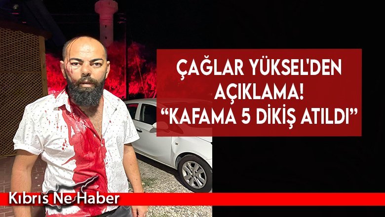 Çağlar Yüksel'den ilk açıklama