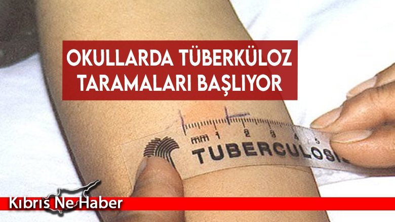Okullarda tüberküloz taramaları başlıyor