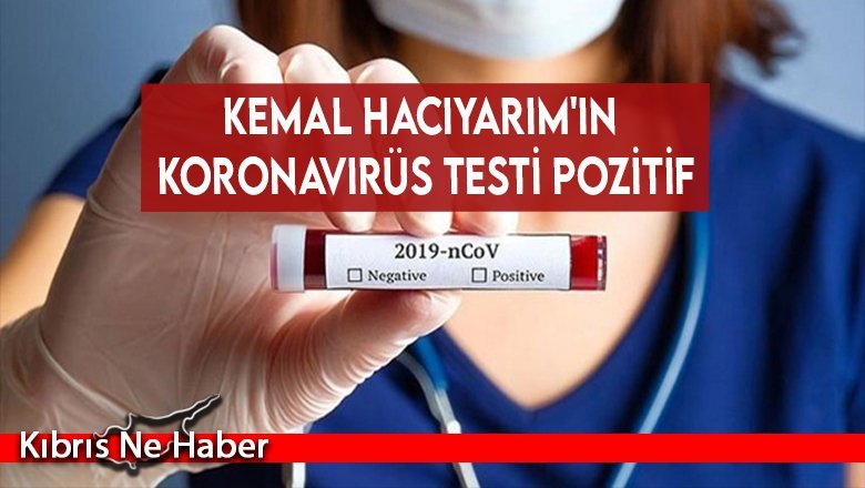 Kemal Hacıyarım'ın koronavirüs testi pozitif