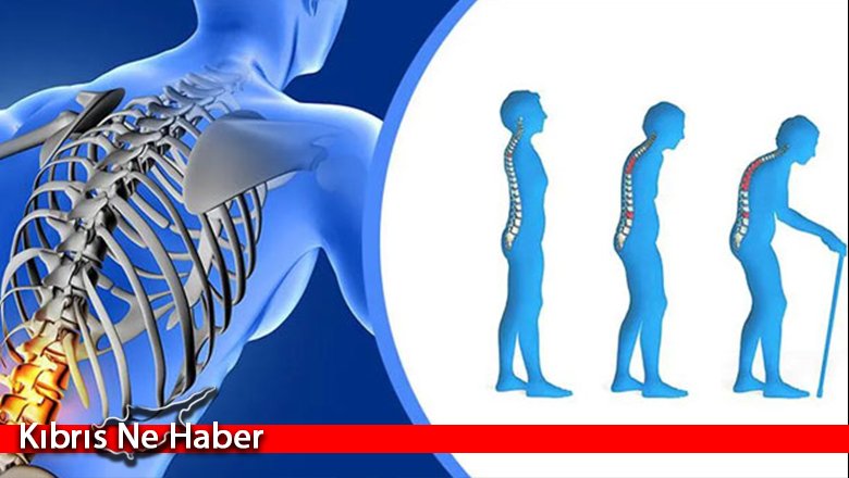Osteoporoz Hastalarının Dikkat Etmesi Gereken 5 Kural