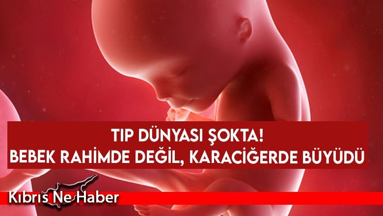 Tıp dünyası şokta! Genç kadın hamile kaldı ama bebek karaciğerinde oluştu