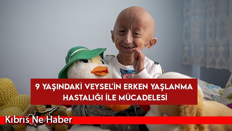 8 milyon kişide 1 görülen hastalığa yakalandı