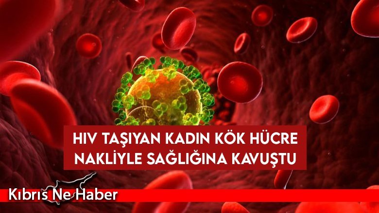 HIV taşıyan kadın kök hücre nakliyle sağlığına kavuştu