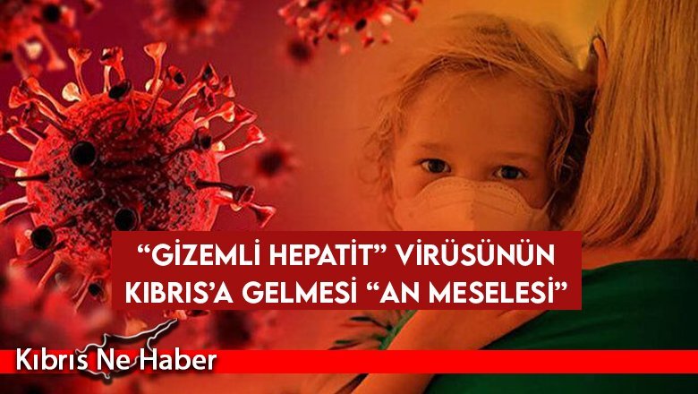 “Gizemli Hepatit” Virüsünün Kıbrıs’a Gelmesi “An Meselesi”