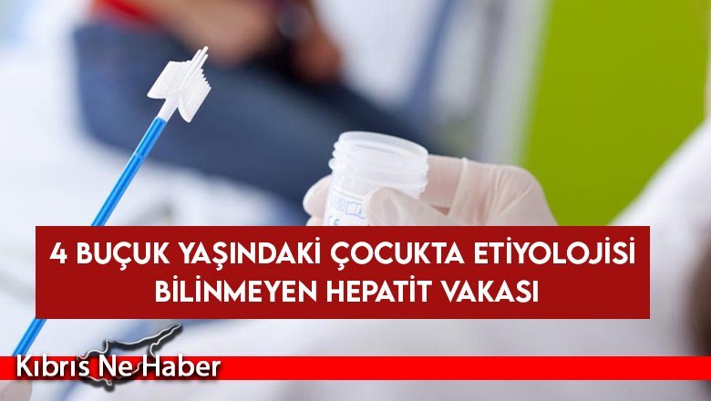4 buçuk yaşındaki çocukta etiyolojisi bilinmeyen hepatit vakası