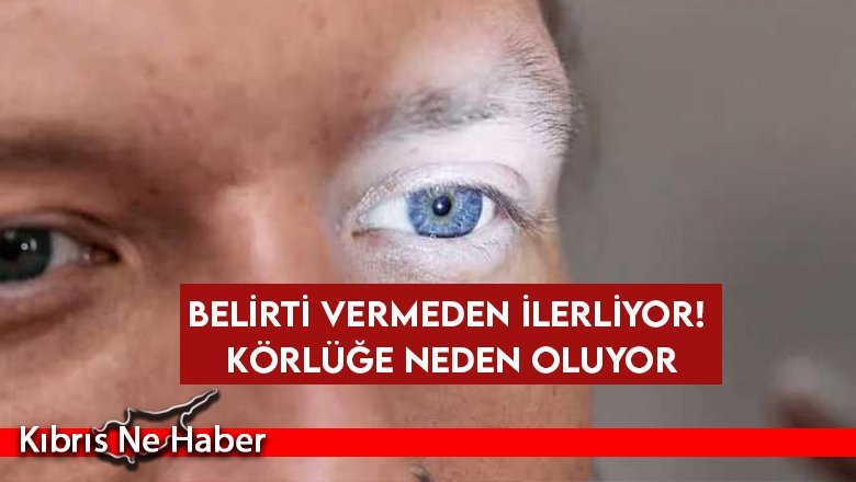 Belirti vermeden ilerliyor! Körlüğe neden oluyor