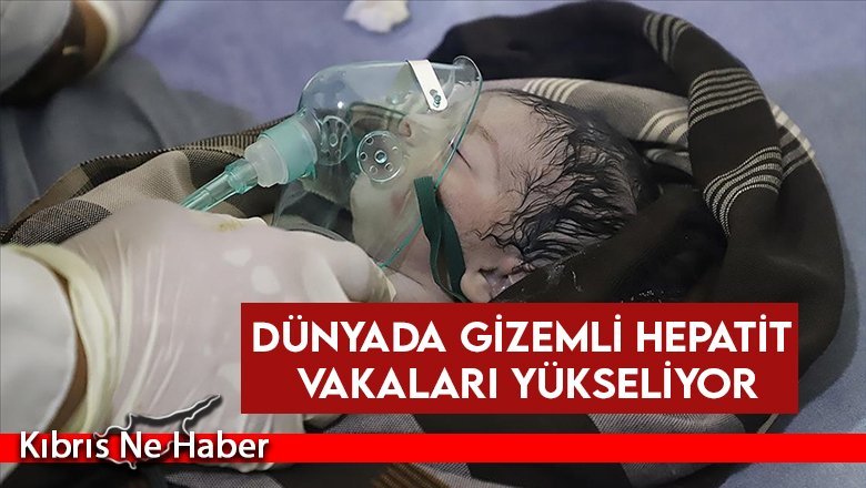 Dünyada gizemli hepatit vakaları yükseliyor...