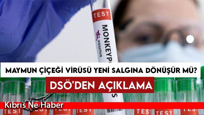Maymun çiçeği virüsü yeni salgına dönüşür mü?