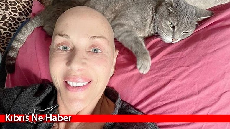 44 kiloya düşen Billur Kalkavan: Kilo almaya başladım