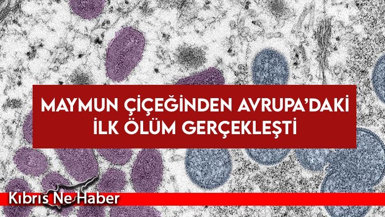 Maymun çiçeğinden Avrupa’daki ilk ölüm gerçekleşti