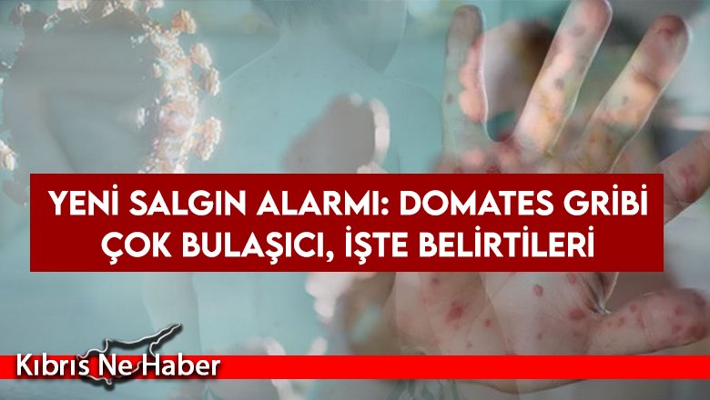 Yeni salgın alarmı: Domates gribi... Bu 5 belirtiye dikkat