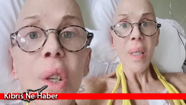 Billur Kalkavan kanserle mücadele ediyor: Kafamdan saç bile çıkıyor