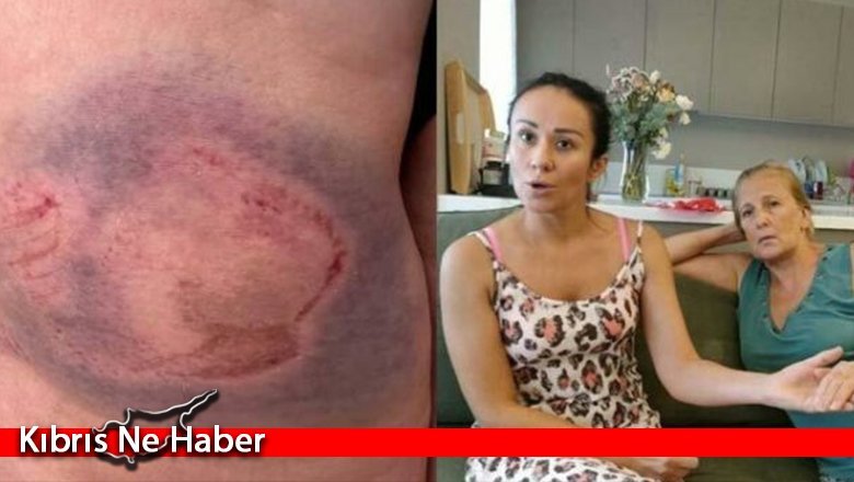 Antalya’da denizde şoke eden olay: “Bir anda ısırdı”