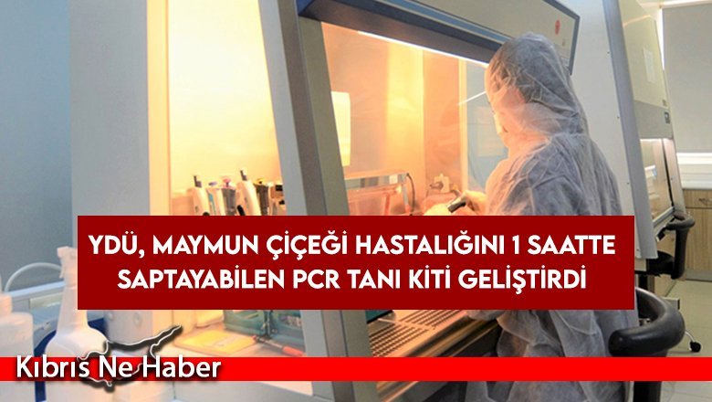 YDÜ, Maymun Çiçeği hastalığını 1 saatte saptayabilen PCR Tanı Kiti geliştirdi