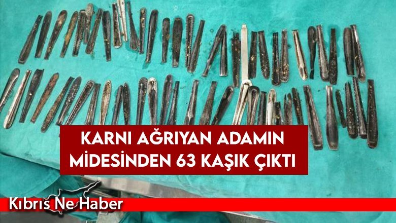 Karnı ağrıyan adamın midesinden 63 kaşık çıktı