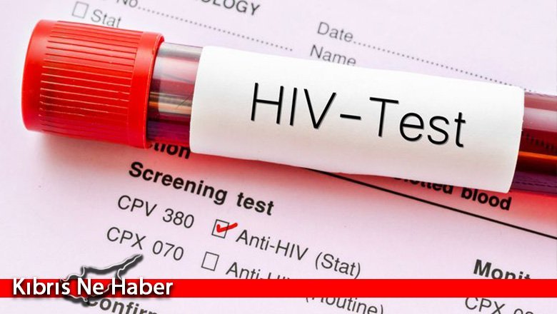 Güney Kıbrıs'ta 4 yeni AIDS varyantı
