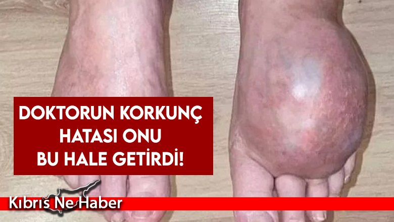 Doktorun korkunç hatası onu bu hale getirdi!