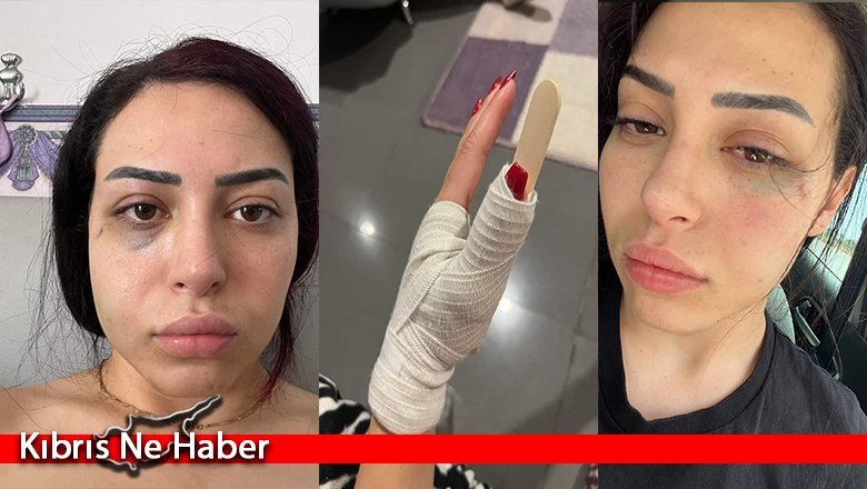 Darp edilen Asya Karaali olayında 2 kişi tutuklandı
