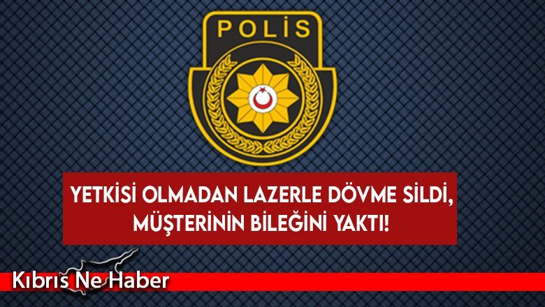 Yetkisi olmadığı halde lazerle dövme sildi, müşterinin bileğini yaktı!