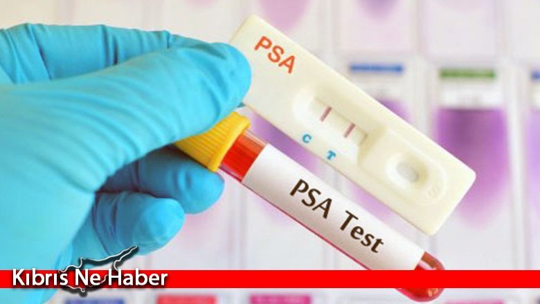 Prostat kanseriyle ilgili ücretsiz tarama testi yapılacak