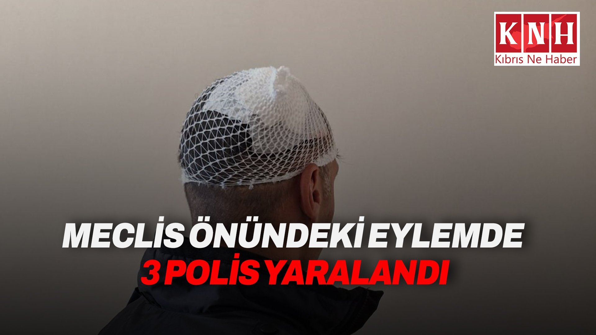 Polis Genel Müdürlüğü: “Eylemde yaralanan 3 polisimizin tedavisi yapılmıştır.''