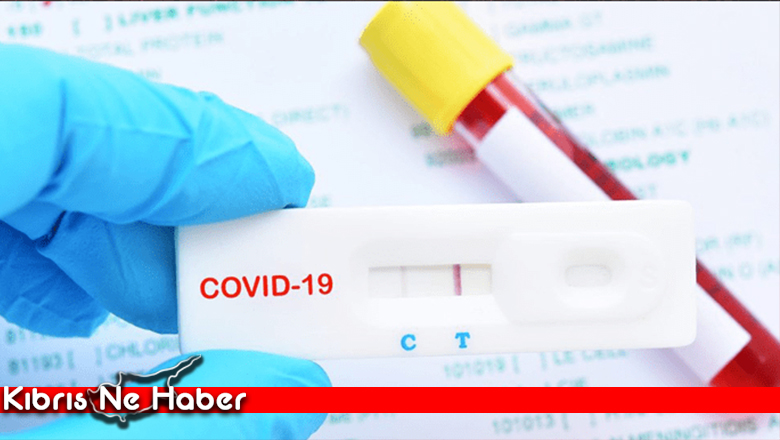 Basın mensuplarına ücretsiz PCR testi yapılacak