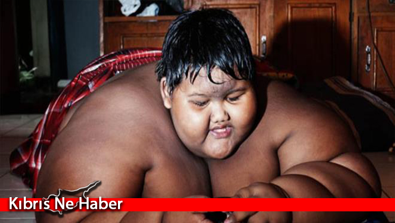 Son hali şoke etti! Dünyanın en şişman çocuğu 110 kilo verdi