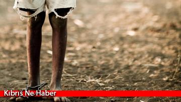 “Yemen’de 400 bin çocuk açlıktan ölme tehlikesiyle karşı karşıya”