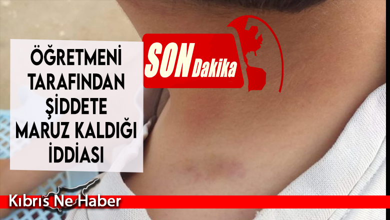 Şok Olay ! Öğretmeni tarafından Şiddete maruz kaldığı iddiası