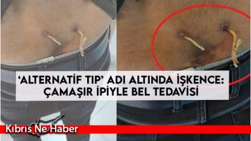 ‘Alternatif tıp’ adı altında işkence: Çamaşır ipiyle bel tedavisi