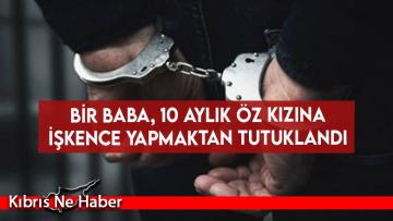 Bir Baba, 10 Aylık Öz Kızına İşkence Yapmaktan Tutuklandı