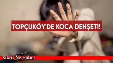 Topçuköy’de koca dehşeti!