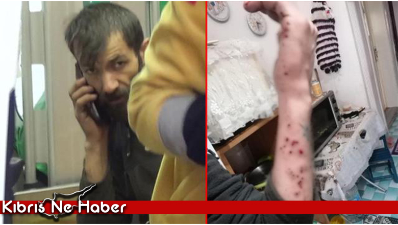 Hurdacının korku dolu anları! Topladığı malzemelerin içinden çıkan bomba fünyesi elinde patladı