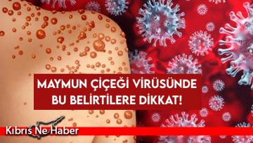 Maymun çiçeği virüsünde bu belirtilere dikkat!