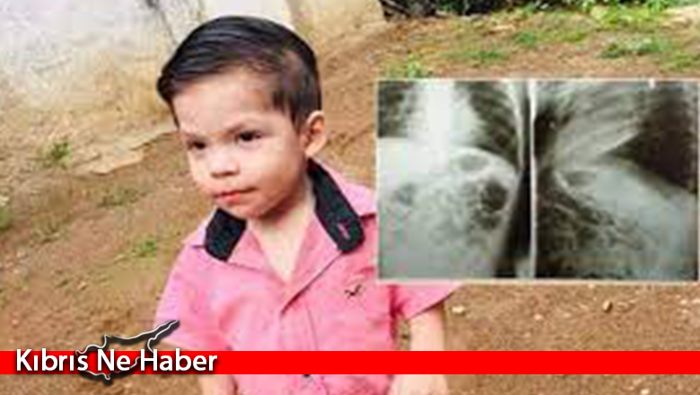 Yuttuğu pil içinde patladı! 2 yaşındaki ufaklık şimdi yaşam savaşı veriyor