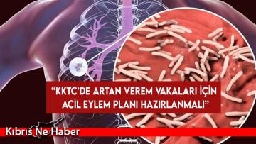 Tabipler Birliği: “KKTC’de artan verem vakaları için acil eylem planı hazırlanmalı”