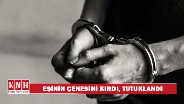 Boşanma aşamasında olduğu eşinin çenesini kırdı, tutuklandı